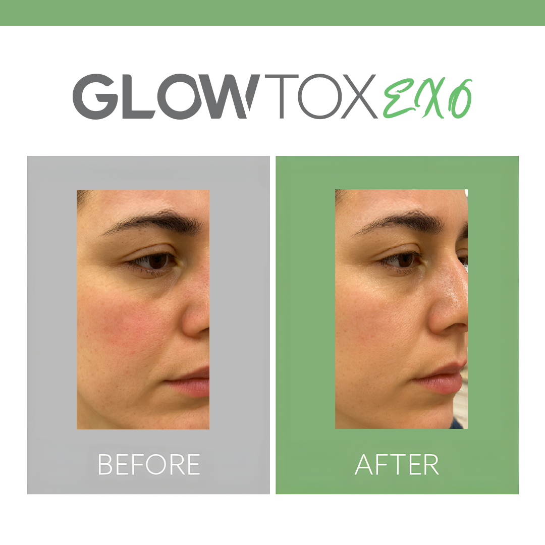 Glowtox 02