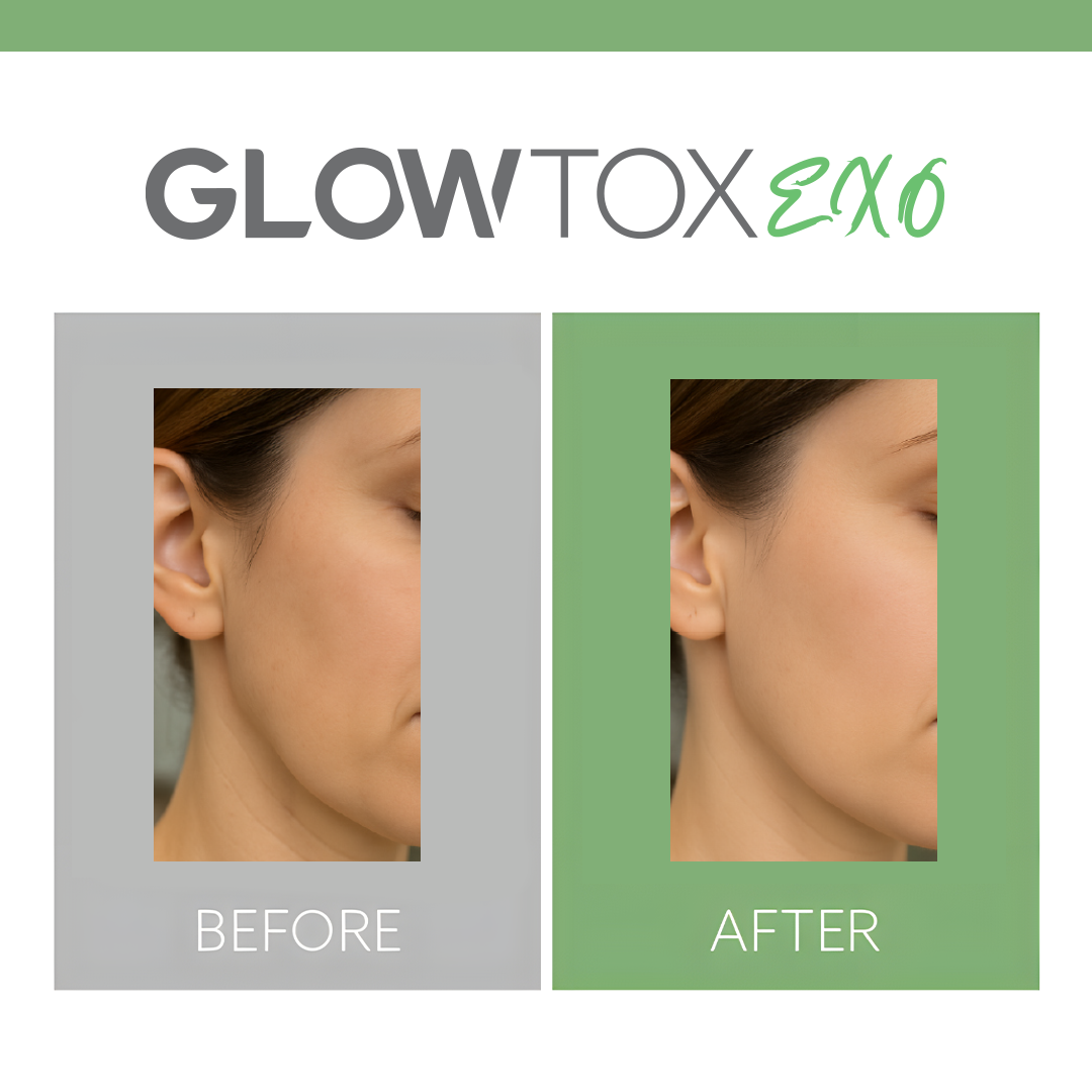 Glowtox 03