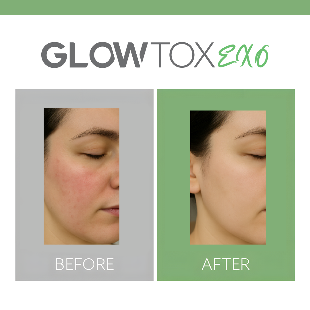 Glowtox 04